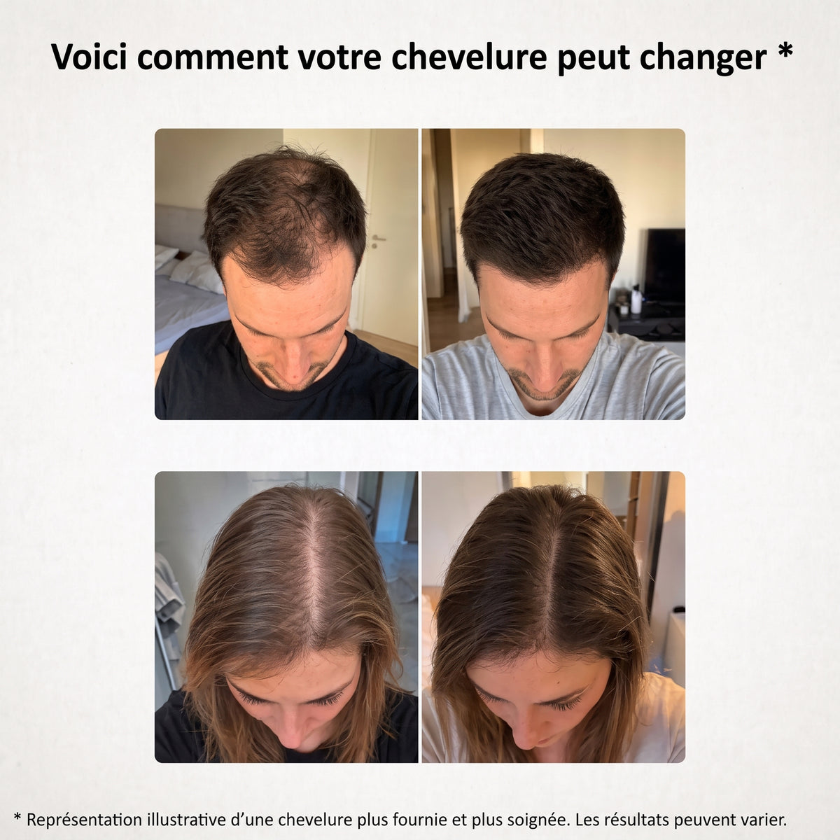 Huile capillaire bio premium Croissance+